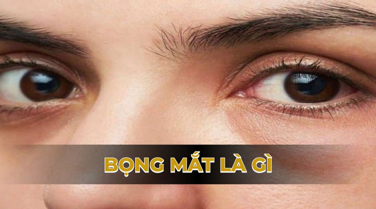 Bọng mawtst là gì