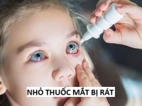 Nhỏ thuốc nhỏ mắt bị rát thường do nguyên nhân nào? Có sao không?