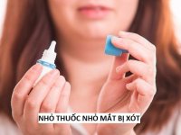 Nhỏ thuốc nhỏ mắt bị xót là do đâu? Cần làm gì và lưu ý điều gì