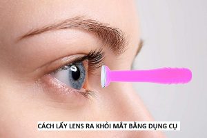 cách lấy lens ra khỏi mắt bằng dụng cụ