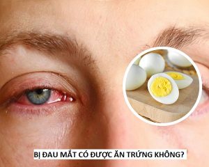 bị đau mắt có được ăn trứng không